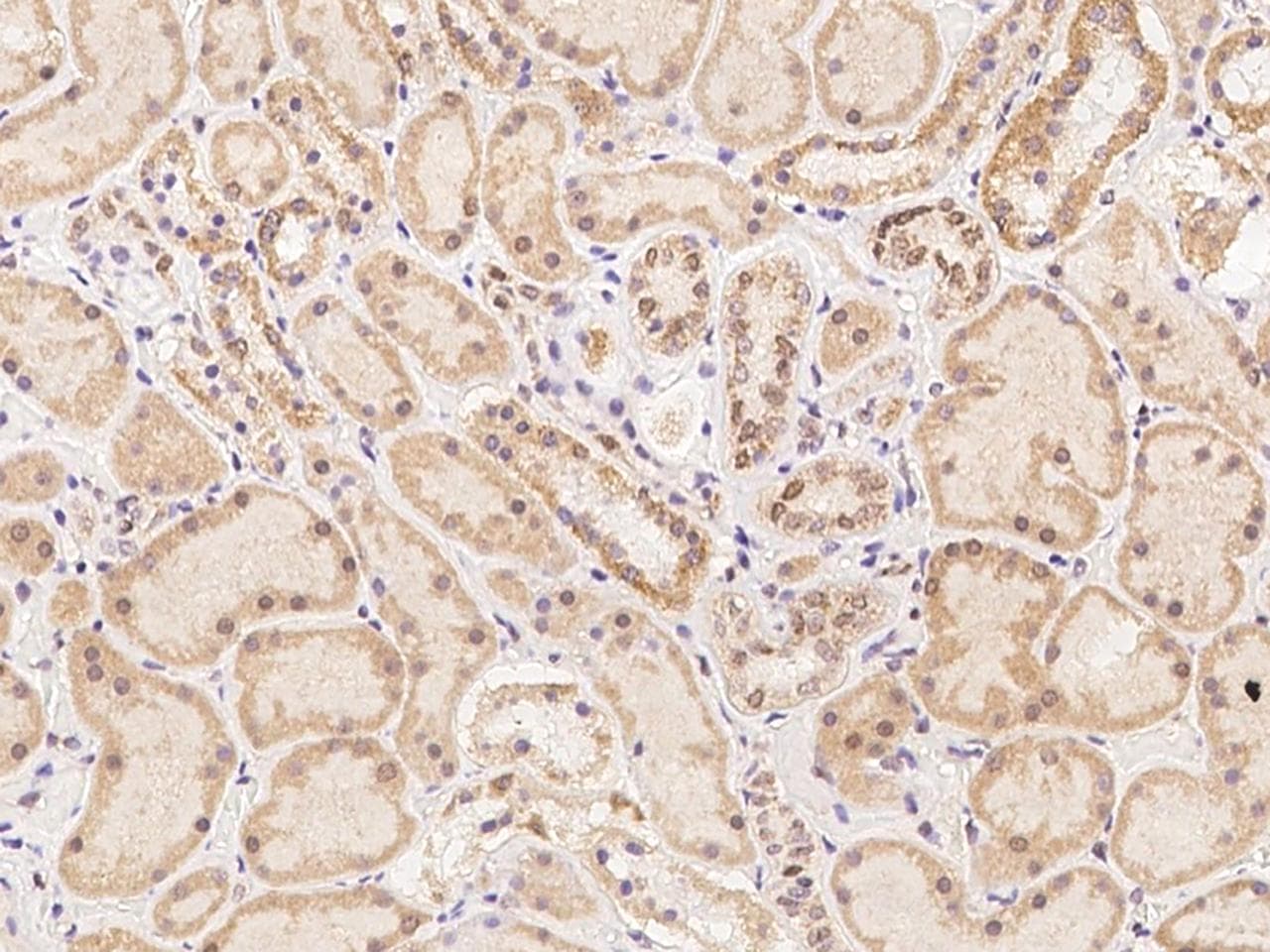 Polyclonal Rabbit anti-Human TEX13B Antibody (IHC)