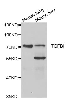 TGFBI Antibody