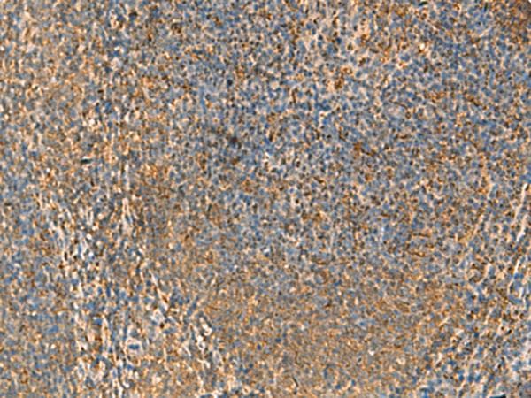 PPP1R1A / IPP1 Antibody