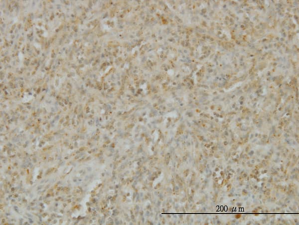 TNFSF14 / LIGHT Antibody (clone 4E3)