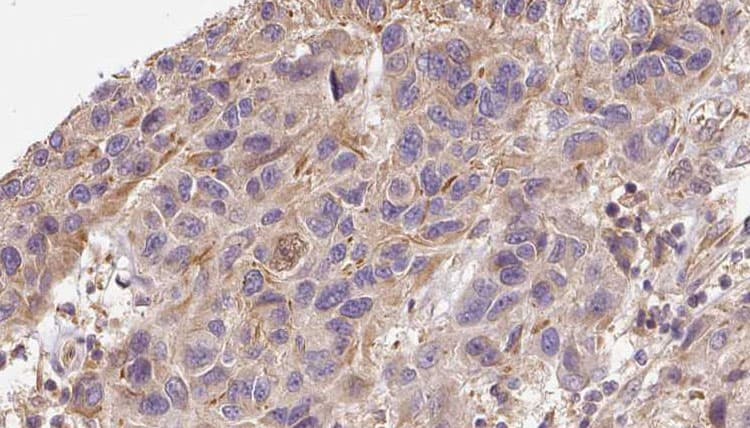 MDK / Midkine Antibody