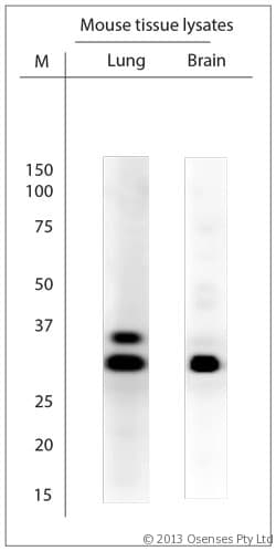 SCAMP1 / SCAMP Antibody (aa2-50)