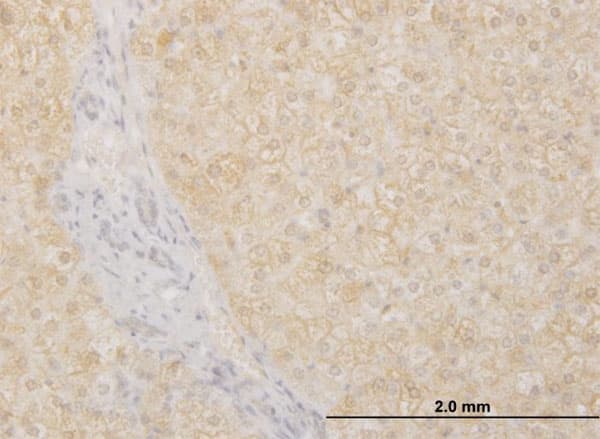 Monoclonal Mouse anti-Human POMGNT1 Antibody (clone 6C12, IHC, WB)