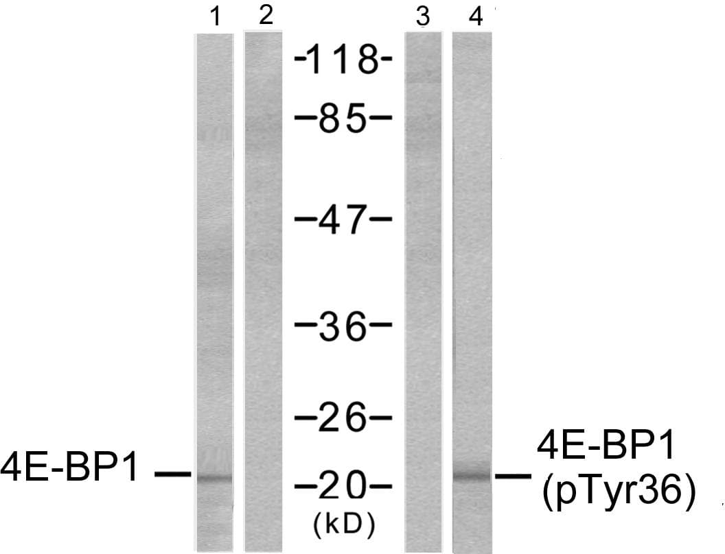 EIF4EBP1 / 4EBP1 Antibody (p36)
