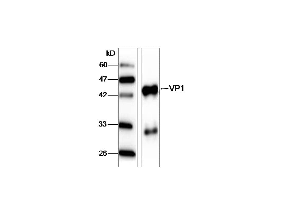 HAV VP1 Antibody (aa7-143)