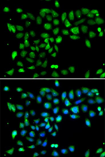 DYRK2 Antibody