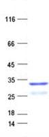 Human C6orf140 / GLYATL3 Protein (Recombinant His, N-Terminal)