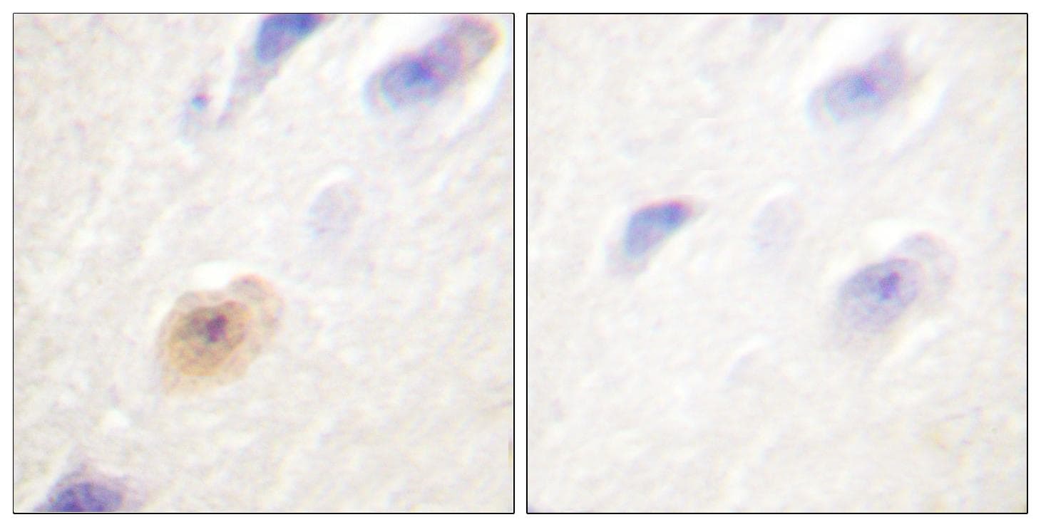 Polyclonal Rabbit anti-Human CSE1L Antibody (IHC, IF, WB)