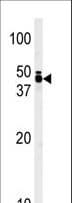 Polyclonal Rabbit anti-Human TRIB1 Antibody (aa341-370, WB)