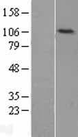 LIG4 / DNA Ligase IV Protein (Over-Expression Lysate Myc-DDK (Flag))