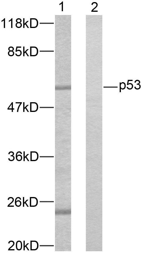TP53 / p53 Antibody (p37)