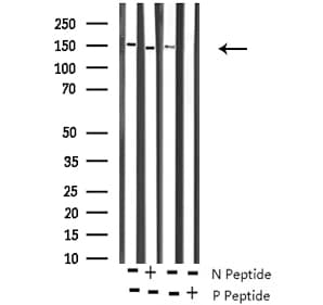 ROCK2 Antibody (phospho-Tyr722)