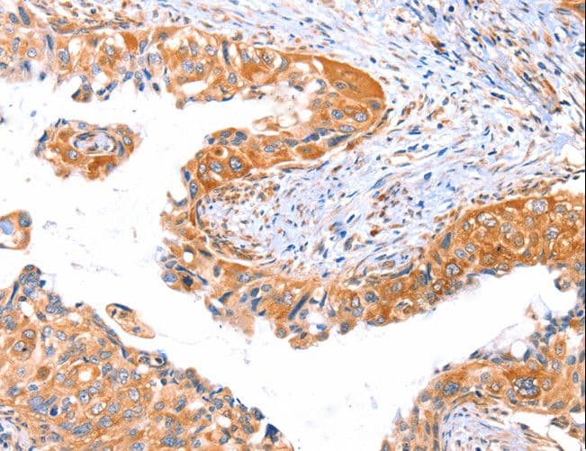AP1B1 / BAM22 Antibody