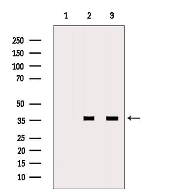 Polyclonal Rabbit anti-Human MSI2 Antibody (WB)