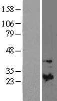 TIMP1 Protein (Over-Expression Lysate Myc-DDK (Flag))