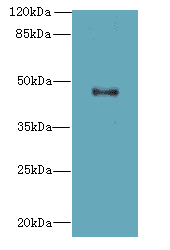 Polyclonal Rabbit anti-Human AADACL2 Antibody (WB)