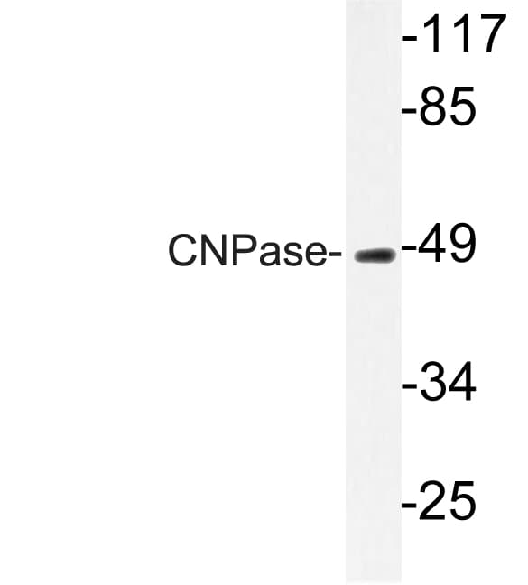 CNPase Antibody (aa59-108)