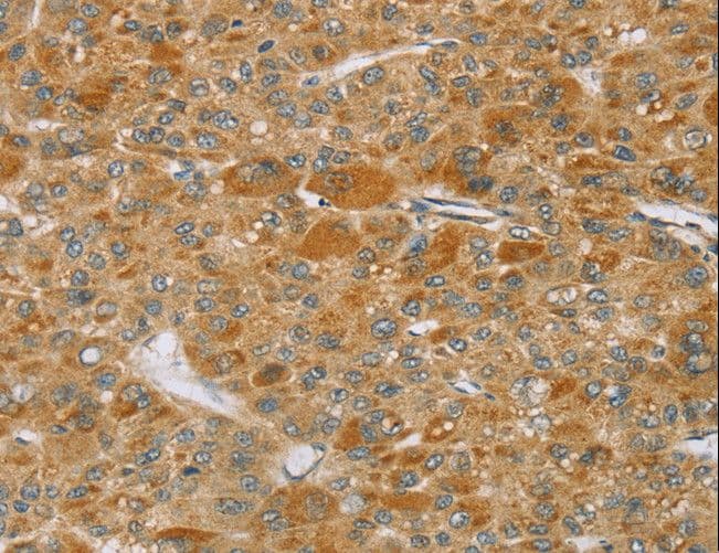 TP53I11 / PIG11 Antibody