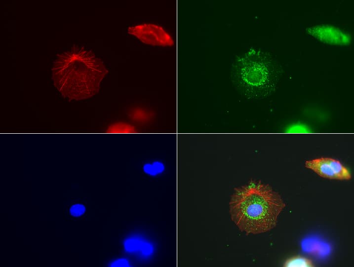 ABAT Antibody (aa29-323, clone UMAB179, Carrier-free)