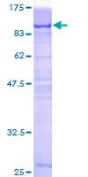 Human PCM1 Protein (Recombinant GST)