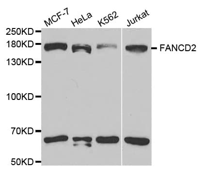 FANCD2 Antibody