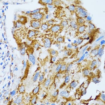 Polyclonal Rabbit anti-Human CLDN11 / Claudin 11 Antibody (IHC, IF, WB)