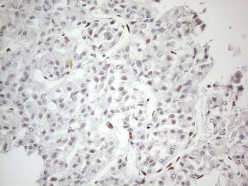 TP53BP1 / 53BP1 Antibody (aa1-300, clone OTI5E1)