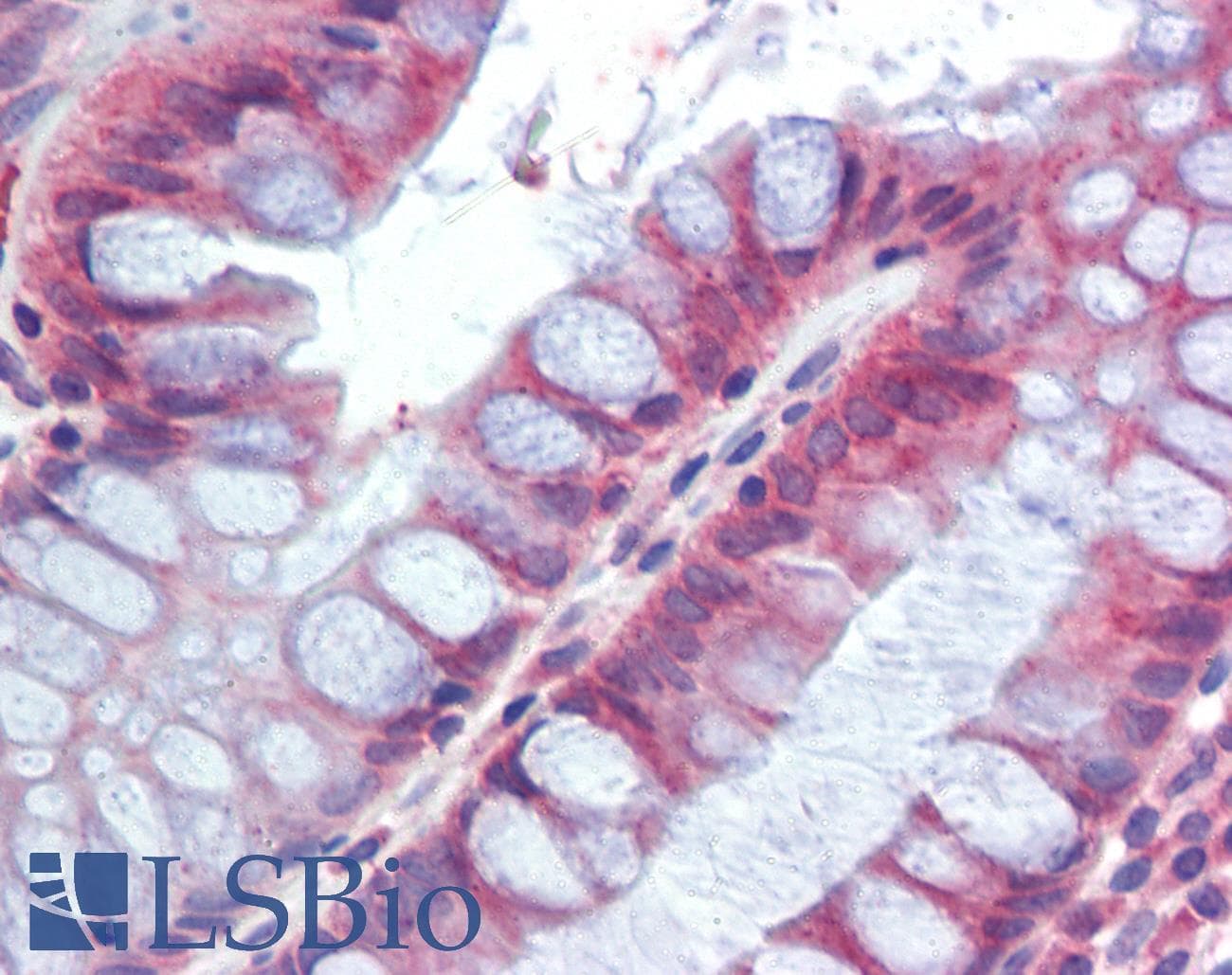IHC-plus™ RETNLB / RELM-Beta Antibody (aa28-41)