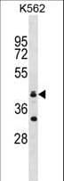 RNF175 Antibody (aa106-134)