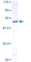 Human FKBP25 / FKBP3 Protein (Recombinant GST)