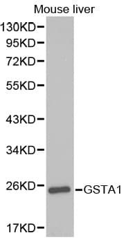 Polyclonal Rabbit anti-Human GSTA1 Antibody (IHC, WB)