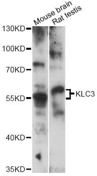 Polyclonal Rabbit anti-Human KLC3 Antibody (WB)