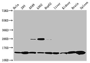 HIST1H2BN Antibody