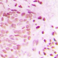 Polyclonal Rabbit anti-Human ATRIP Antibody (N-Terminus, IHC, IF, WB)