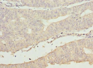 BBS2 / BBS Antibody