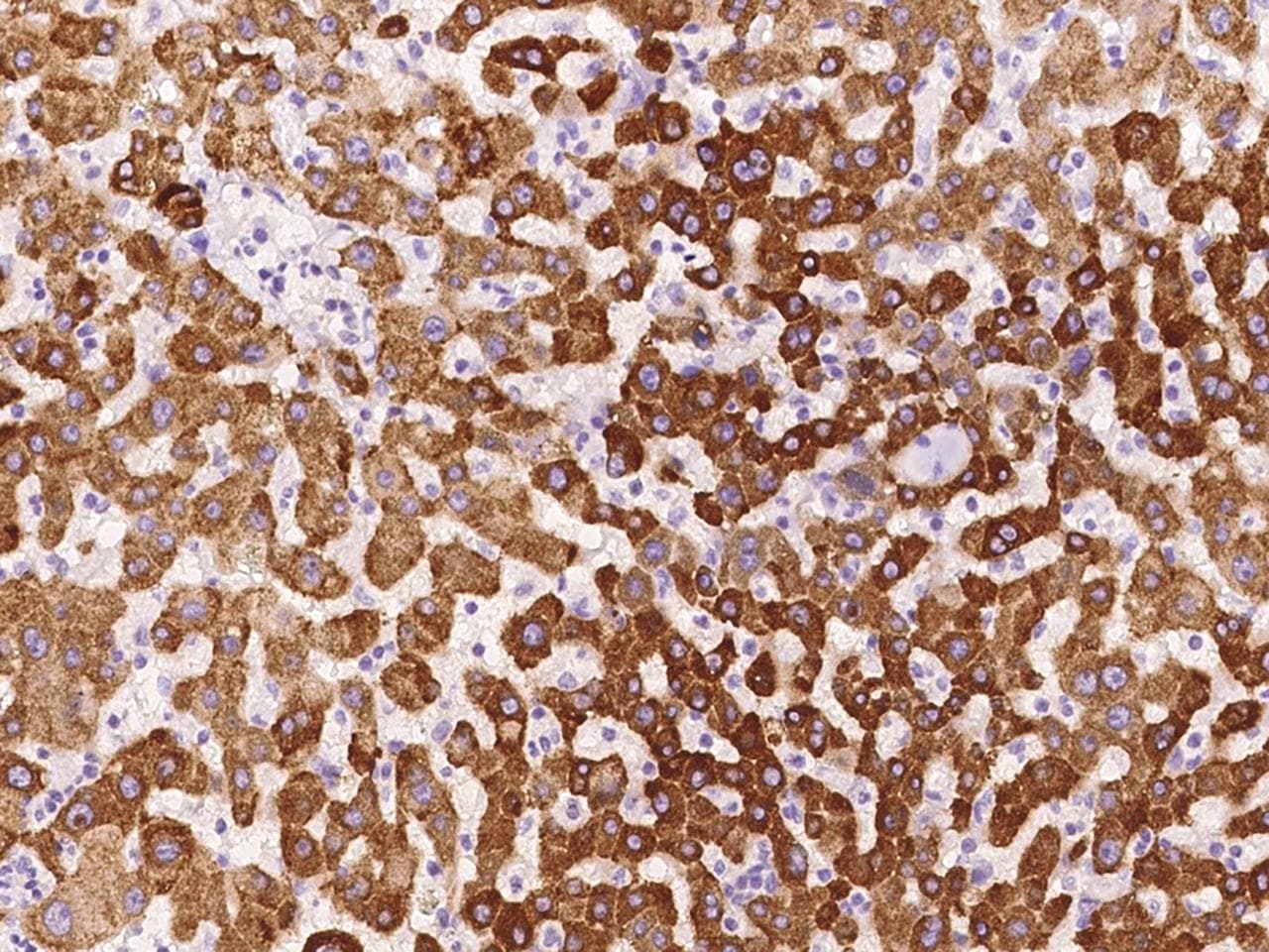 RITA1 / C12orf52 Antibody