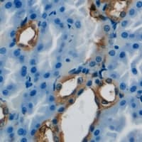 Trimethylguanosine Synthase 1 Antibody