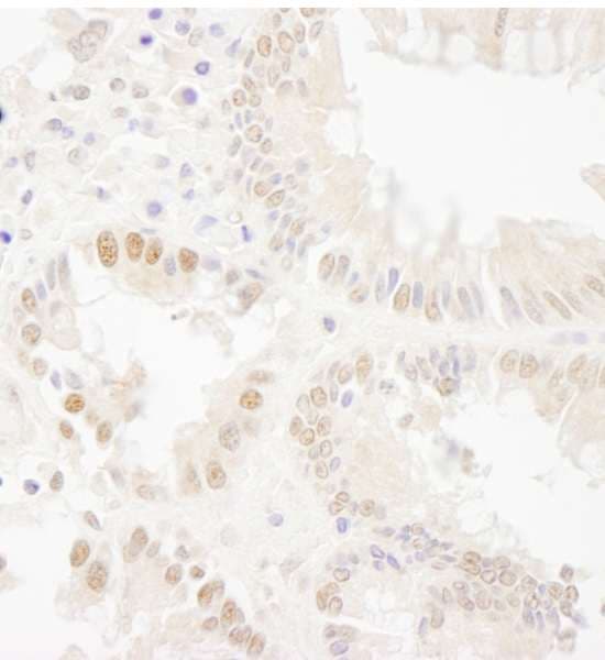 Polyclonal Rabbit anti-Human BUB1 Antibody (aa1-50, IHC, WB)