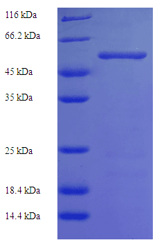 Human HK1 / Hexokinase 1 Protein (Recombinant His)