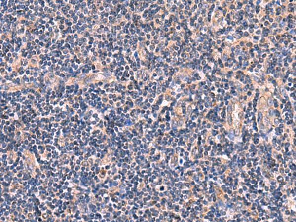 MYOT / Myotilin Antibody