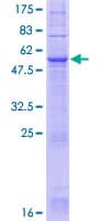 Human JKAMP Protein (Recombinant GST)