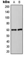 Polyclonal Rabbit anti-Human SYT1 / Synaptotagmin Antibody (Internal, IHC, WB)