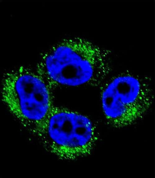 AP1M1 Antibody (aa199-227)