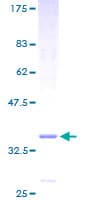 Human TMEM14A Protein (Recombinant GST)