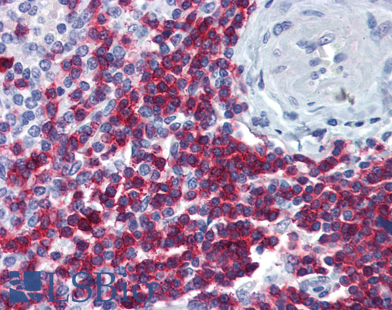 IHC-plus™ Monoclonal Mouse anti-Human CD247 / CD3 Zeta Antibody (clone 4A12-F6, IHC, WB)