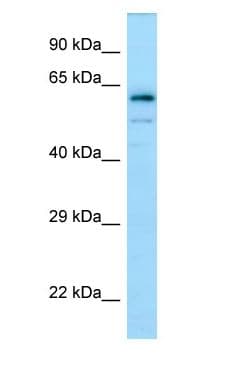 DPYSL4 / CRMP3 Antibody (C-Terminus)