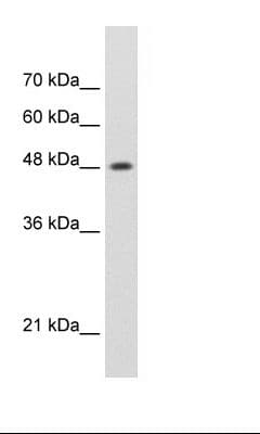 Polyclonal Rabbit anti-Human SMARCE1 / BAF57 Antibody (N-Terminus, IHC, WB)