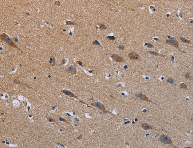Polyclonal Rabbit anti-Human PLXND1 / Plexin D1 Antibody (IHC)