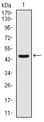 IHC-plus™ Monoclonal Mouse anti-Human ASS1 / ASS Antibody (clone 2C10, IHC, WB)