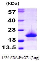 Human MB / Myoglobin Protein (Recombinant 6His, N-terminus)
